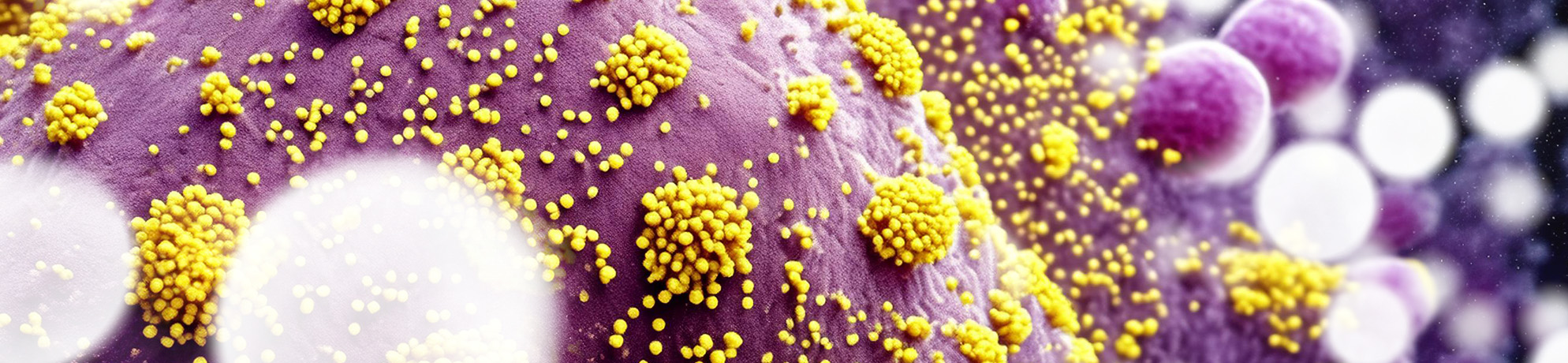 Single, large, smooth, purple cell structure with yellow, clustered viruses attached 