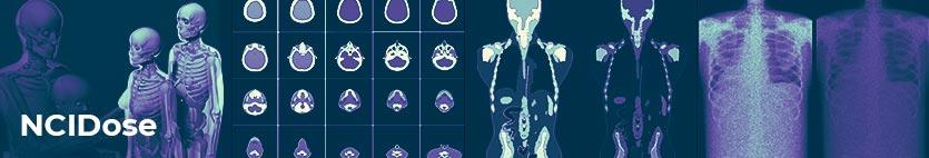 Image showing various body scans plus 3d models of human bodies that have organs and bones visible with NCIDose text on top
