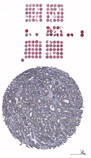 Composite image showing a circular tissue section and multiple rows of small, circular red dots above it. The tissue section appears in shades of blue and gray and the red dots are organized in a grid-like pattern.