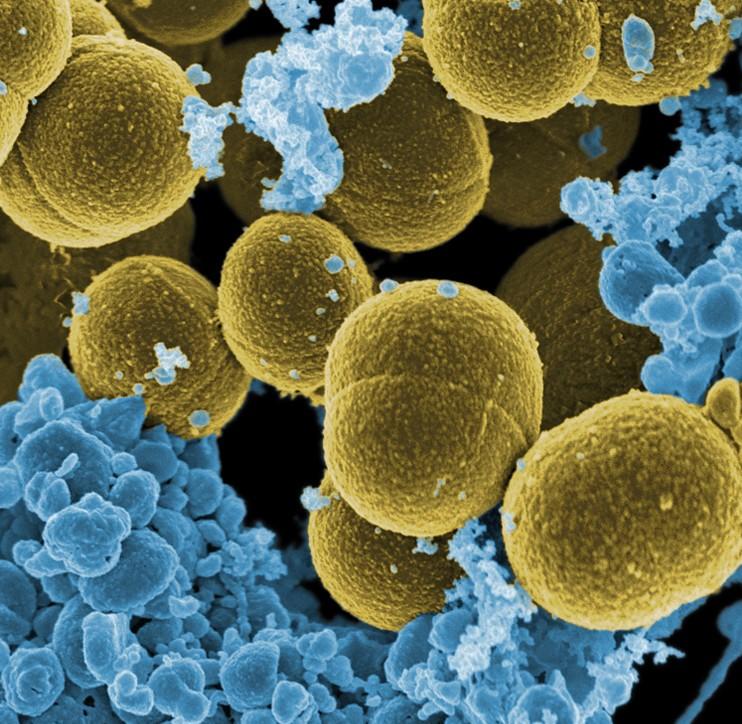 Scanning electron micrograph image of white blood cells and bacteria.
