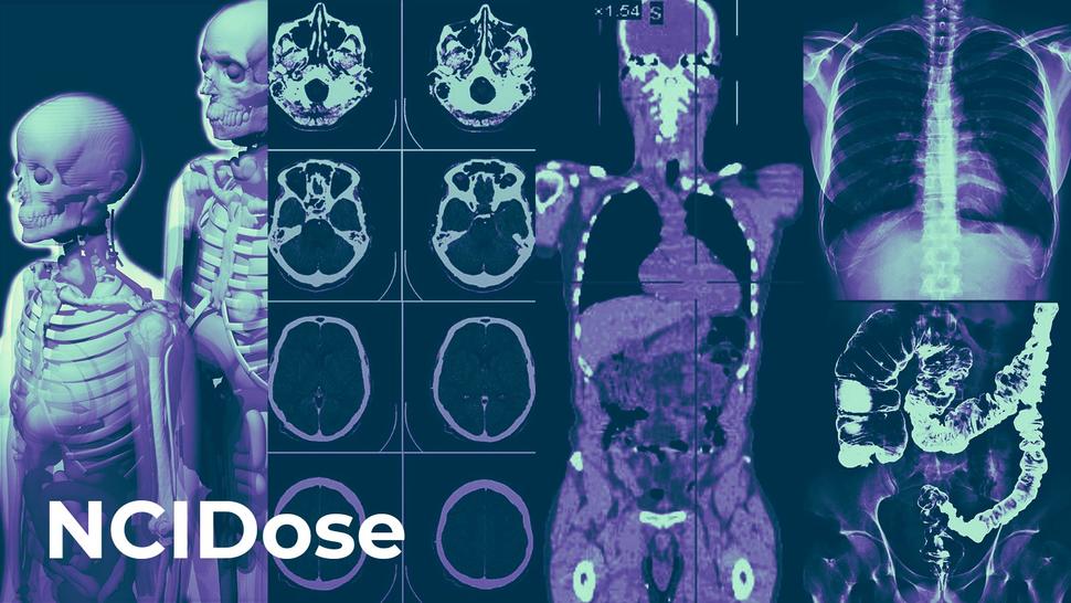 NCI Dose Banner Image