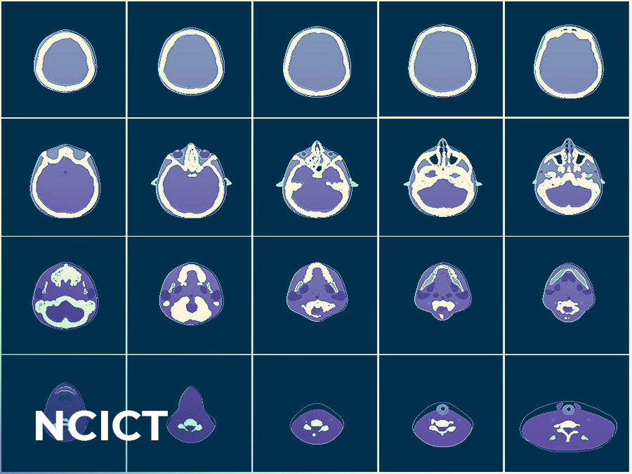 NCICT text on top of brain scans