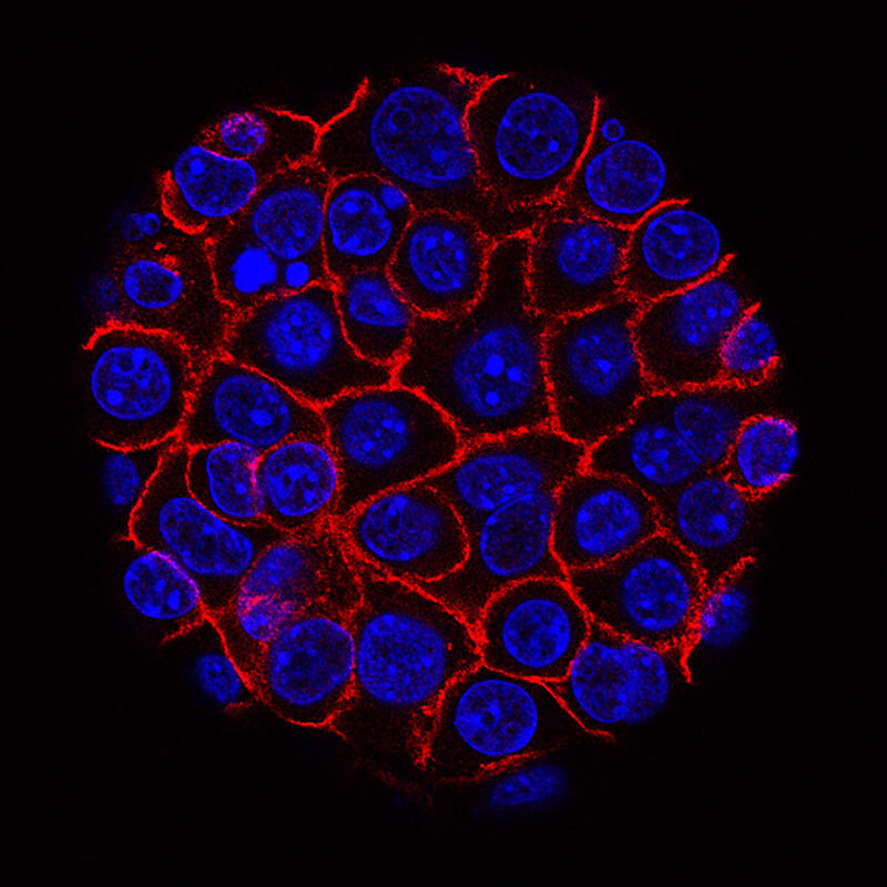 This image shows pancreatic cancer cells (nuclei in blue) growing as a sphere encased in membranes (red).
