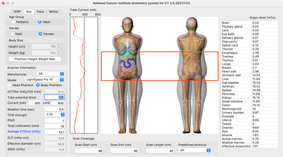 Screenshot of NCICT display, part of NCIDose tools