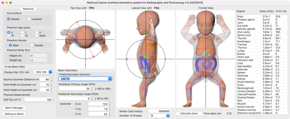 Screenshot of NCIRF part of NCIDose tools