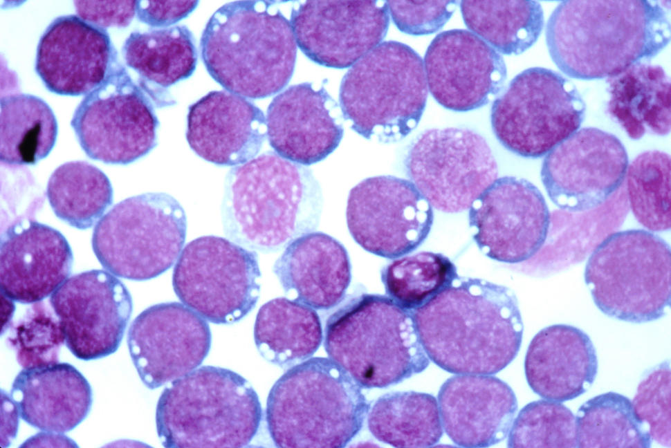 microscope image of Epstein-Barr Virus