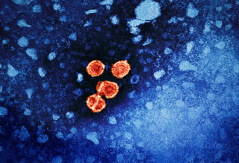 Colorized transmission electron micrograph of hepatitis B virus particles (colorized red and yellow on a blue background).