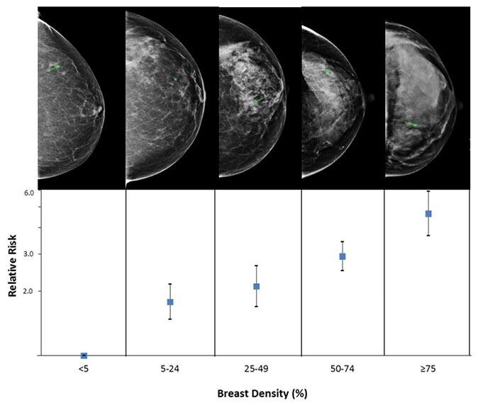 mammograms showing breast density