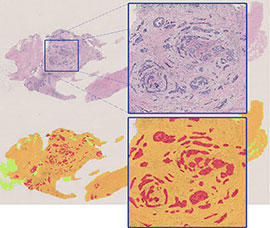 research image showing histologic features of breast tissue