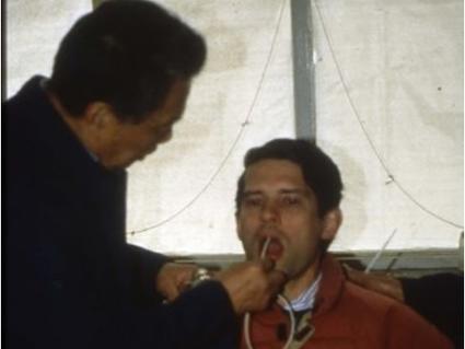 photograph of two men, one undergoing esophageal cytology with a balloon.