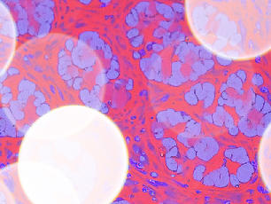 Abstract radiologic, microscopic image of computational pathology