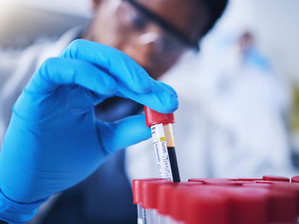 A blue gloved hand lifts a blood sample vial out of an array of other samples. In the background, the blurry head and body of the scientist can be seen; the scientist wears safety goggles and is a black man. The background is light and bright, but also blurry, indicating a lab environment that is out of focus.
