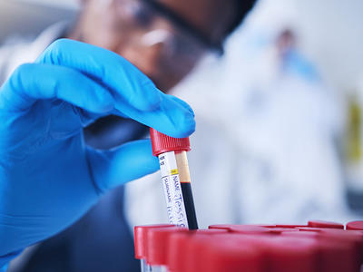 A blue gloved hand lifts a blood sample vial out of an array of other samples. In the background, the blurry head and body of the scientist can be seen; the scientist wears safety goggles and is a black man. The background is light and bright, but also blurry, indicating a lab environment that is out of focus.