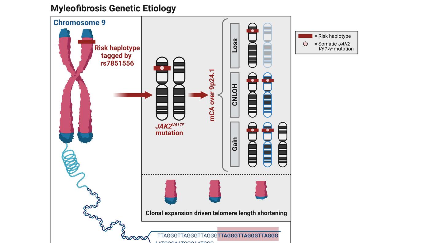 A proposed conceptual framework of myelofibrosis genetic etiology.