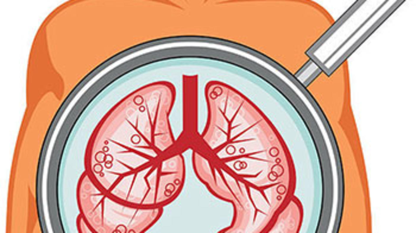 sketch of lungs