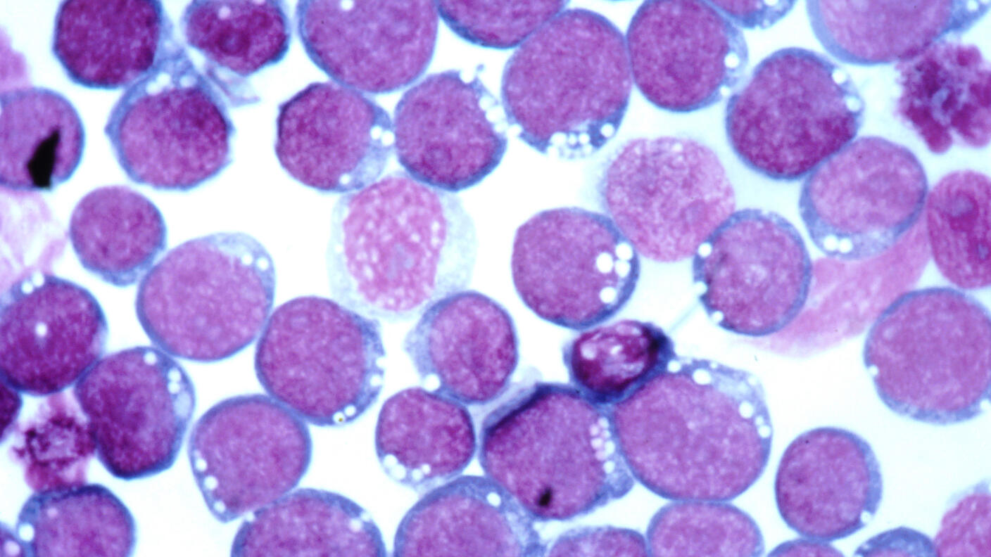 microscope image of Epstein-Barr Virus