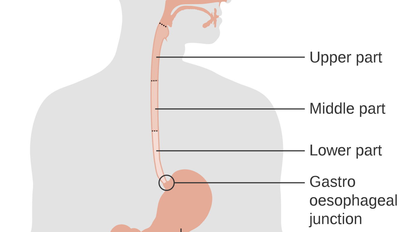 diagram of the esophagus