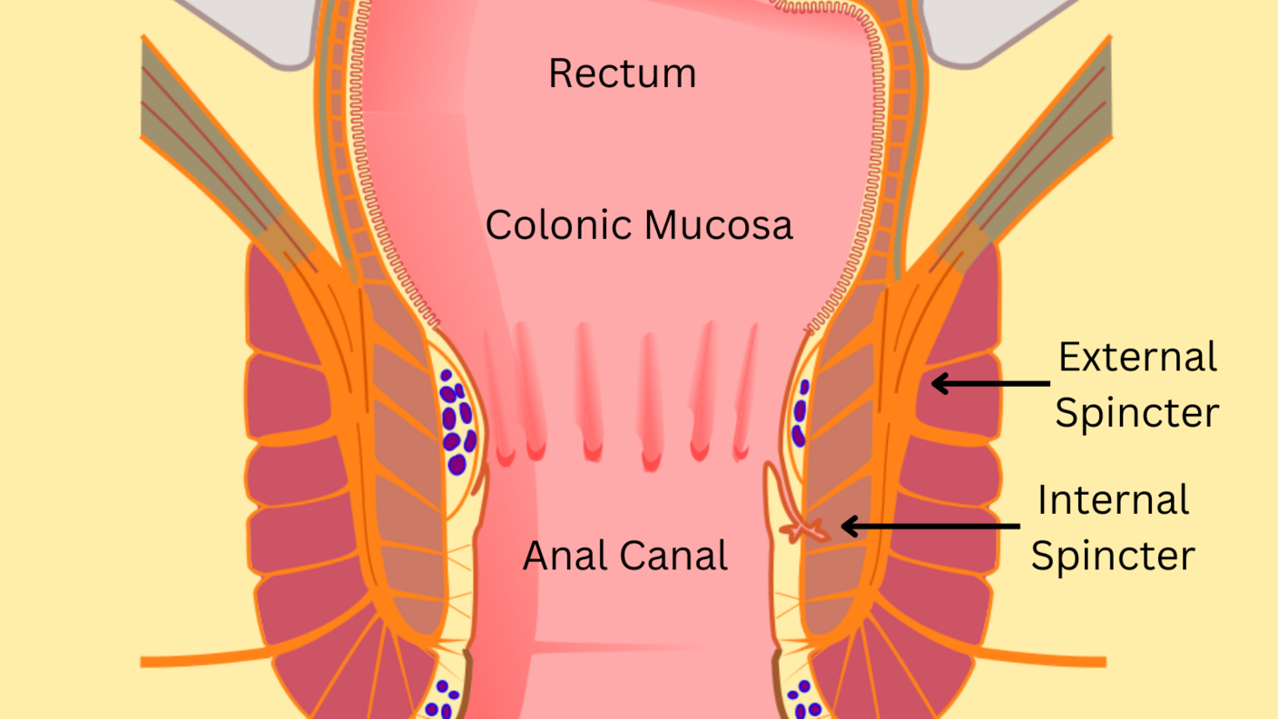 Labeled drawing of anal anatomy. The rectum, colonic mucosa, external and internal spincter, anal canal, anal verge, and perianus are labeled.