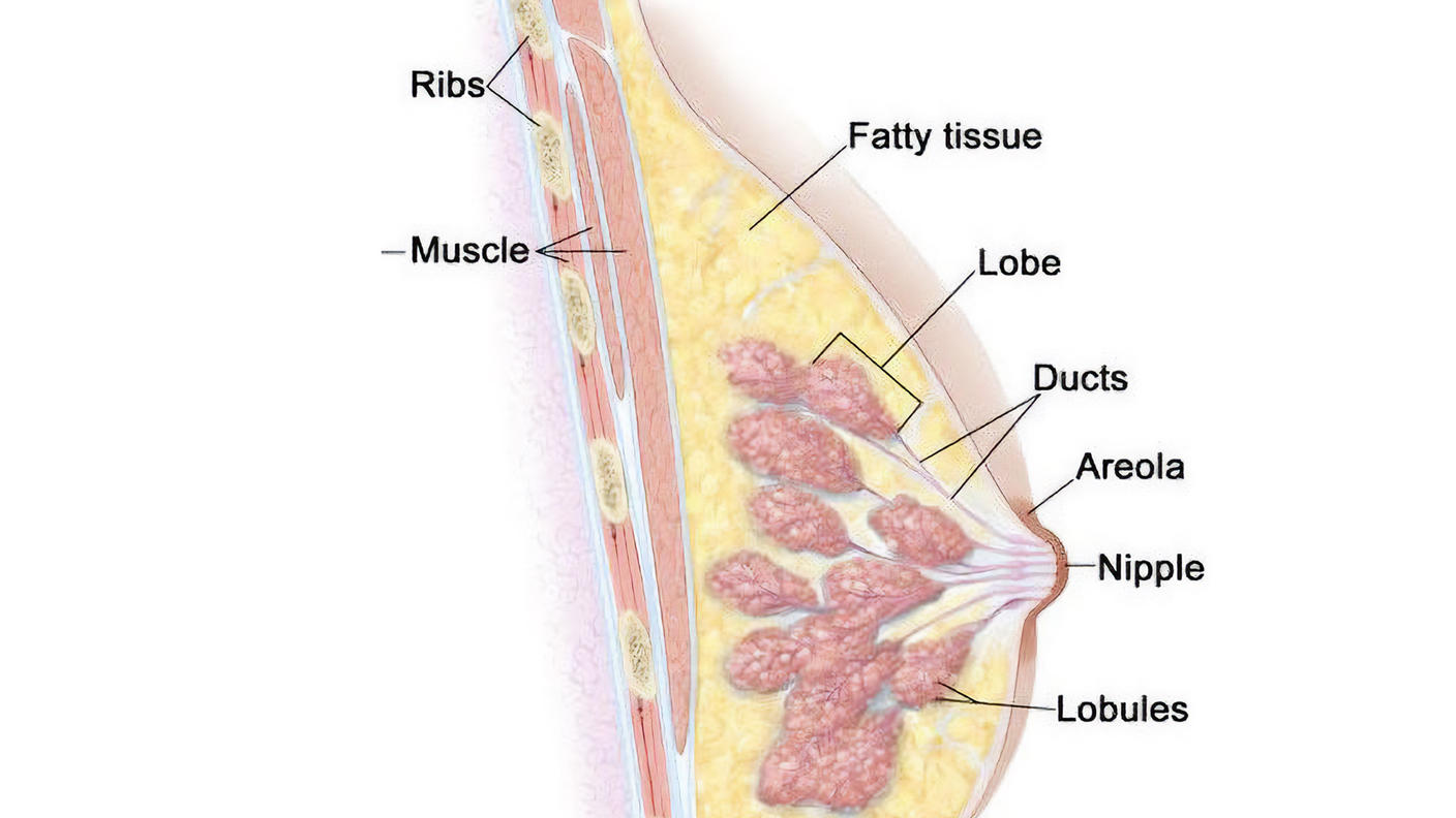 A cross section illustration of a female breast, labeling the chest wall, fatty tissue, lobe, ducts, areola, nipple, lobules, muscle and ribs. The chest wall, muscle, lobules, lobes, nipples and areola are various shades of pink; the fatty tissue is yellow.