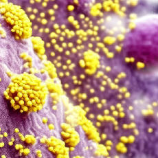 Single, large, smooth, purple cell structure with yellow, clustered viruses attached 