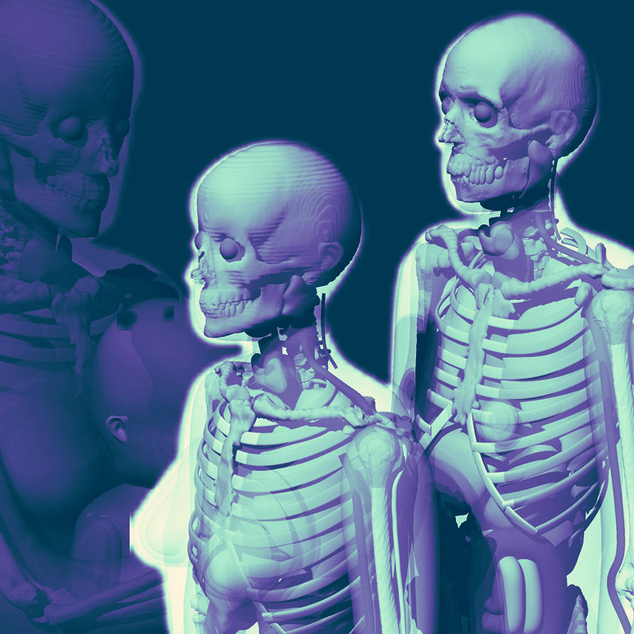 A composite image of two sets of phantoms. On the left is a mother holding her child. The opacity is very low and the image is colored medium to dark purple. On the right is a set of female and male phantoms, with visible bones and an outline of where the body would be. They are colored light green, teal, and purple.