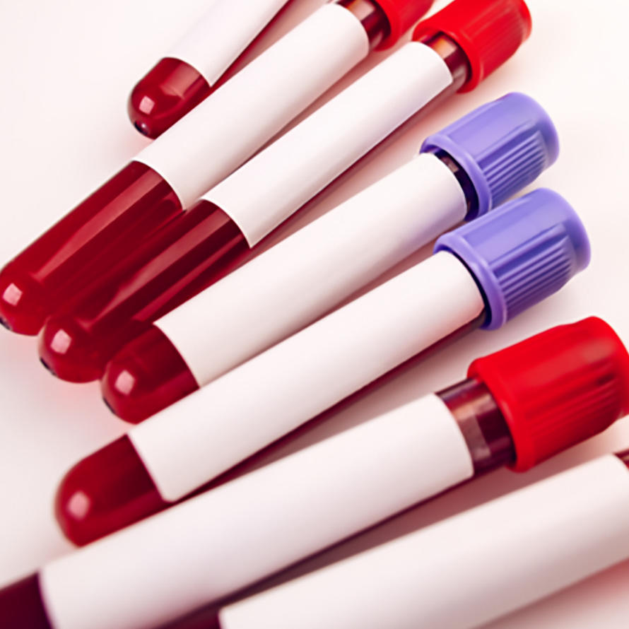 A composite image which shows seven blood vials on the left with red and purple caps and blank labels on the left and three PFAS chemical bonds (PFOS, PFNA, and PFOA) on the right.