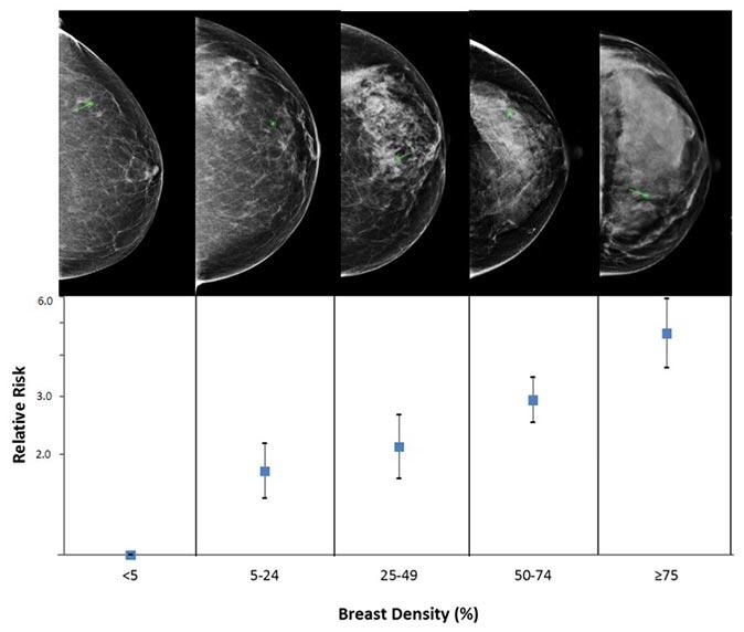 Measuring breast density
