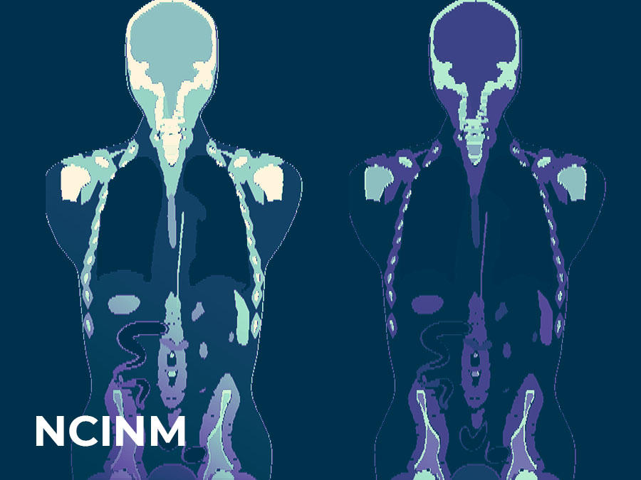 NCICM text on top of upper body scan images