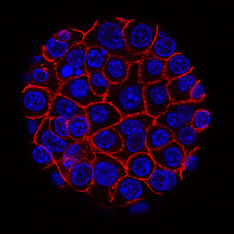 This image shows pancreatic cancer cells (nuclei in blue) growing as a sphere encased in membranes (red).