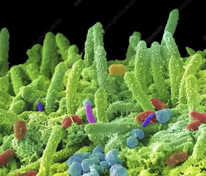 Colored scanning electron micrograph (SEM) of mixed oral bacteria. 