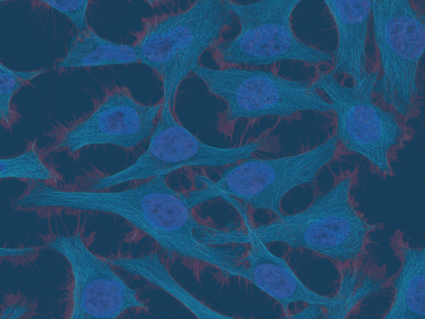 Multiphoton fluorescence image of HeLa cells stained with the actin binding toxin phalloidin (red), microtubules (cyan) and cell nuclei (blue).