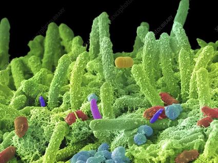 Colored scanning electron micrograph (SEM) of mixed oral bacteria. 