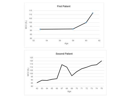 Two line graphs. First patient shows MCV values starting at around 91fL at age 35 to 58, which then increased to 112 fL at age 61. The graph of the second patient shows MCV starting at 85 fL at age 62, steadily increasing to 120 fL at age 75, with a spike to 115-110 fL at ages 67-68.