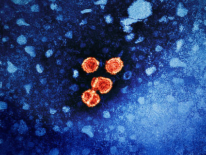 Colorized transmission electron micrograph of hepatitis B virus particles (colorized red and yellow on a blue background).