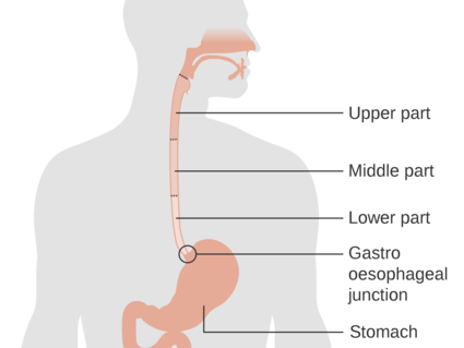 diagram of the esophagus