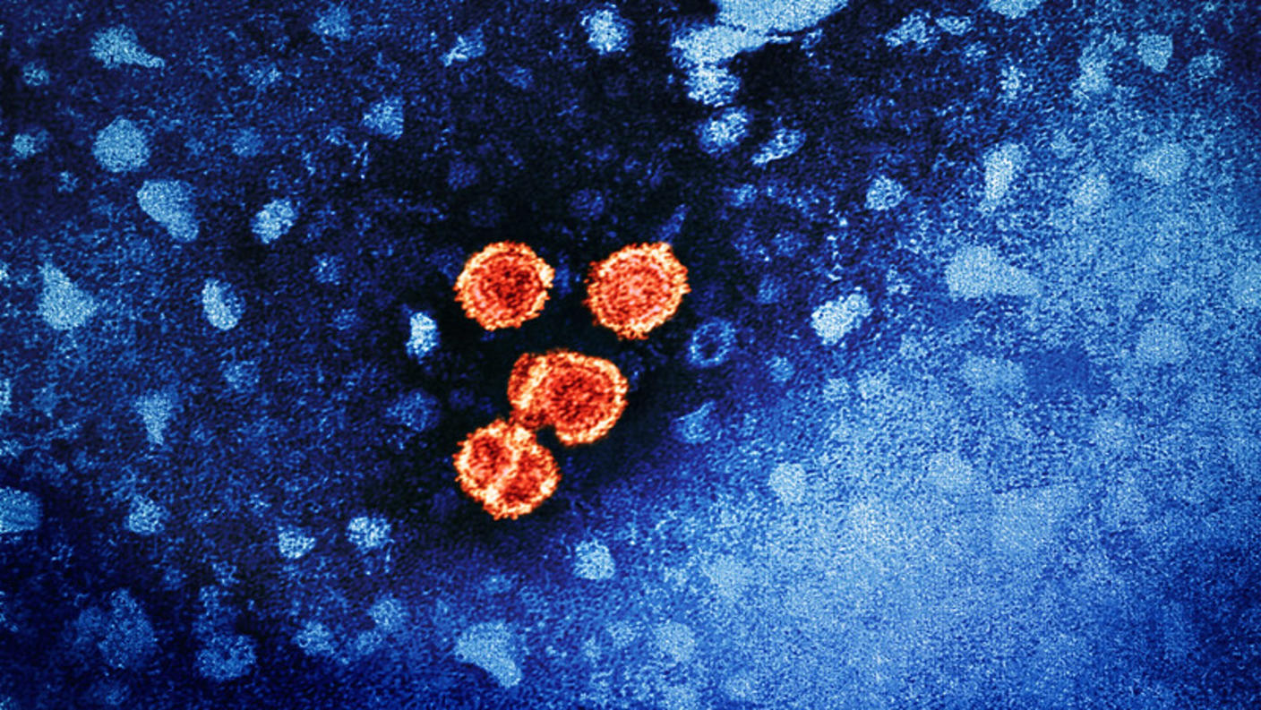 Colorized transmission electron micrograph of hepatitis B virus particles (colorized red and yellow on a blue background).