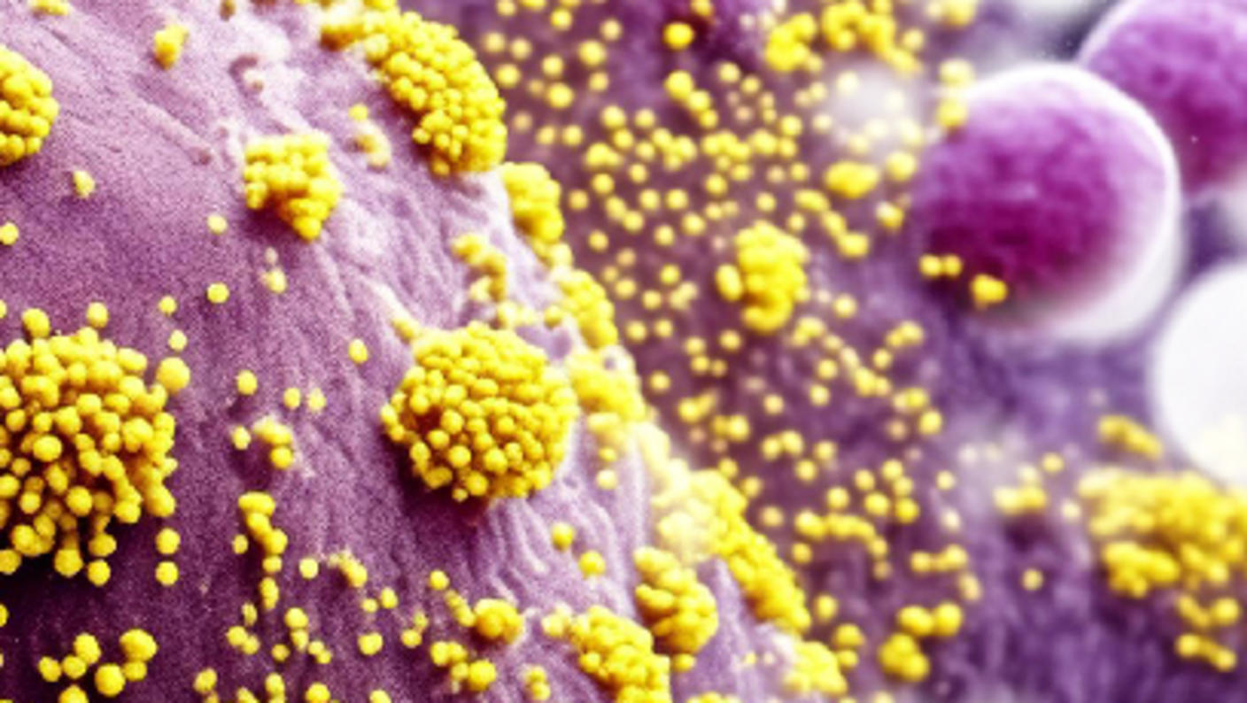 Single, large, smooth, purple cell structure with yellow, clustered viruses attached 
