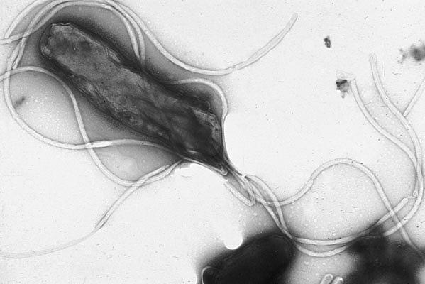 Electron micrograph of Helicobacter pylori