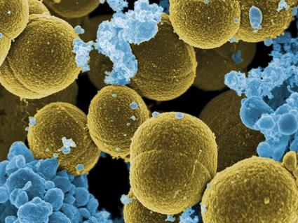 Scanning electron micrograph image of white blood cells and bacteria.